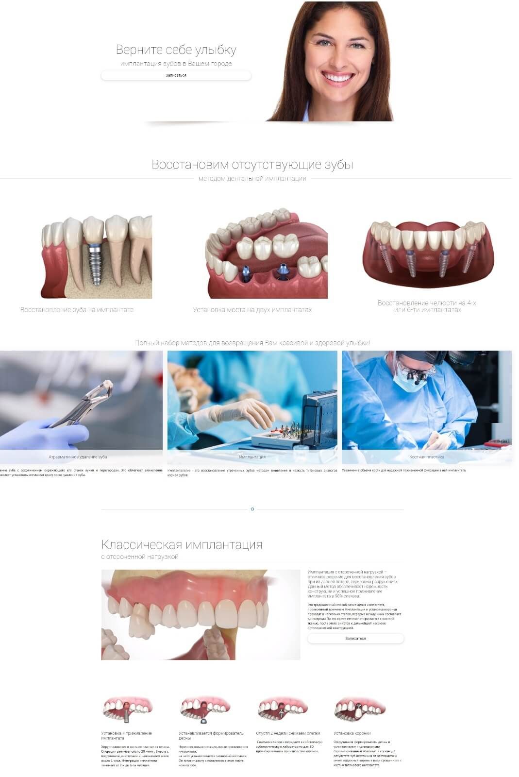 Страница сайта стоматологии об имплантации